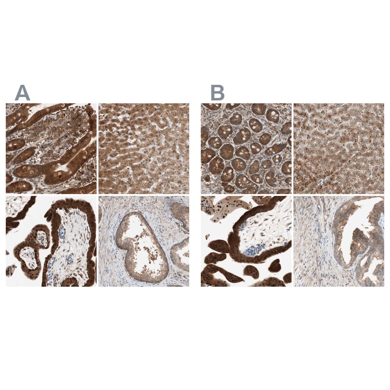 GALT Antibody - BSA Free Immunohistochemistry-Paraffin: GALT Antibody - BSA Free [NBP1-86138]