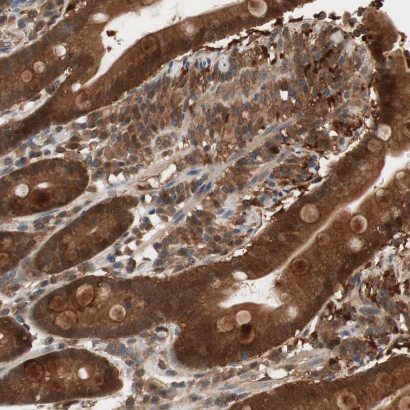 GALT Antibody - BSA Free Immunohistochemistry-Paraffin: GALT Antibody - BSA Free [NBP1-86138]