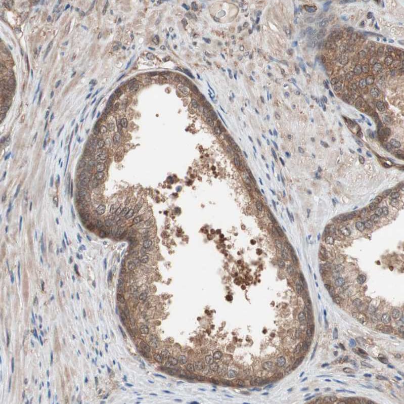 GALT Antibody - BSA Free Immunohistochemistry-Paraffin: GALT Antibody - BSA Free [NBP1-86138]