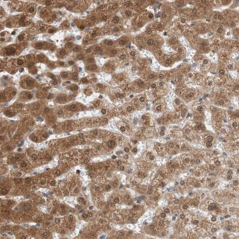 GALT Antibody - BSA Free Immunohistochemistry-Paraffin: GALT Antibody - BSA Free [NBP1-86138]