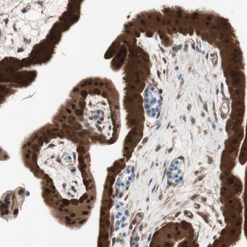 GALT Antibody - BSA Free Immunohistochemistry-Paraffin: GALT Antibody - BSA Free [NBP1-86138]