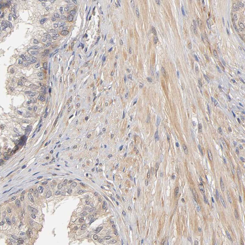 PDE5A Antibody - BSA Free Immunohistochemistry-Paraffin: PDE5A Antibody - BSA Free [NBP1-86139]