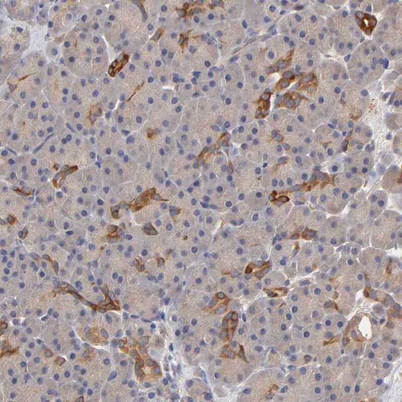 PDE5A Antibody - BSA Free Immunohistochemistry-Paraffin: PDE5A Antibody - BSA Free [NBP1-86139]
