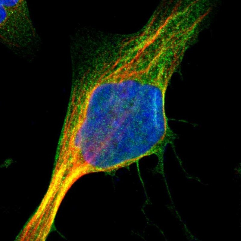 PYGL Antibody - BSA Free Immunocytochemistry/ Immunofluorescence: PYGL Antibody - BSA Free [NBP1-86147]