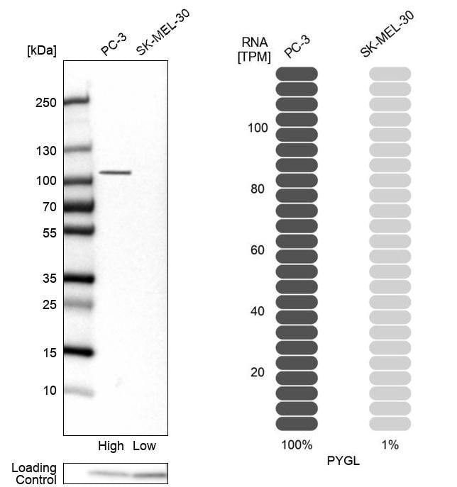 PYGL Antibody - BSA Free Western Blot: PYGL Antibody - BSA Free [NBP1-86147]