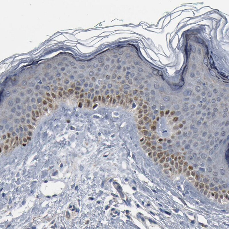 SOX6 Antibody - BSA Free Immunohistochemistry-Paraffin: SOX6 Antibody - BSA Free [NBP1-86149]