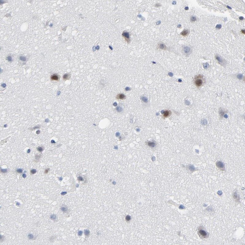 SOX6 Antibody - BSA Free Immunohistochemistry-Paraffin: SOX6 Antibody - BSA Free [NBP1-86149]