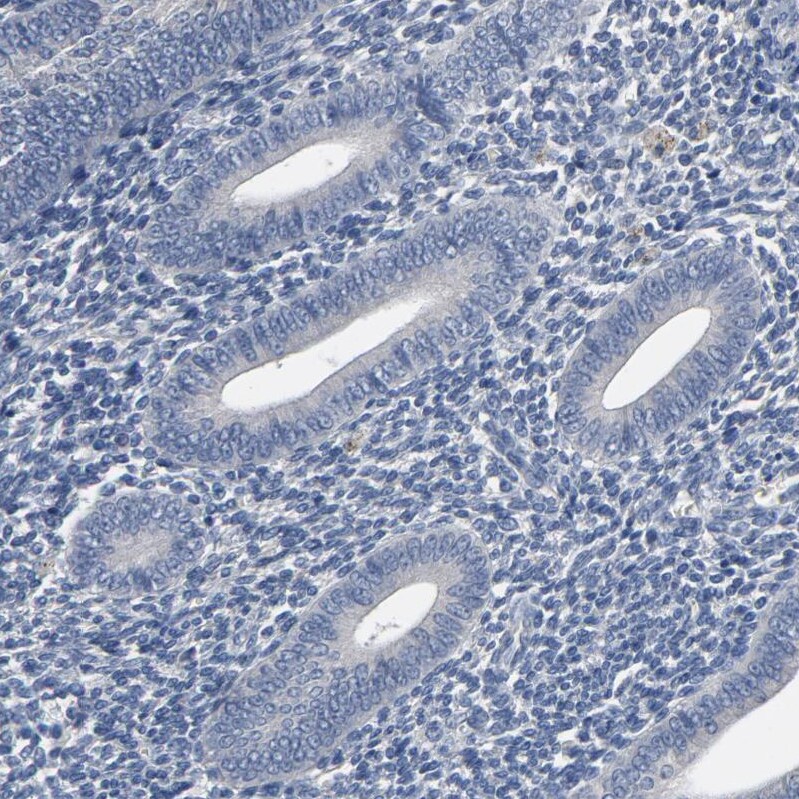 SOX6 Antibody - BSA Free Immunohistochemistry-Paraffin: SOX6 Antibody - BSA Free [NBP1-86149]
