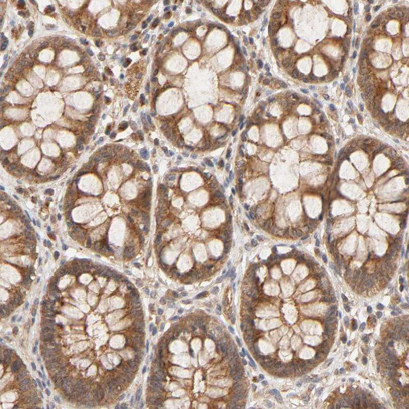 Eps8 Antibody - BSA Free Immunohistochemistry-Paraffin: Eps8 Antibody - BSA Free [NBP1-86150]