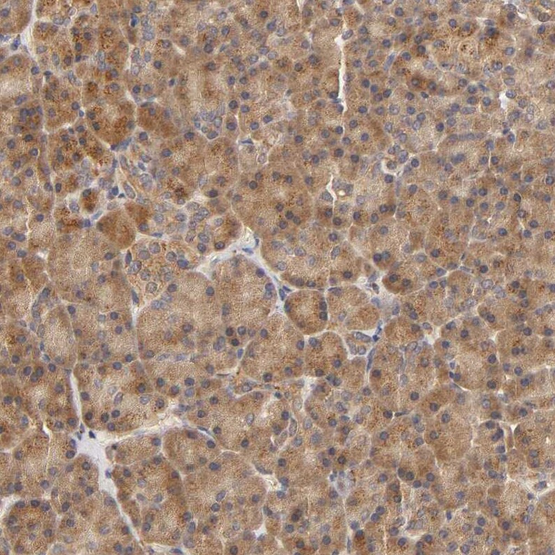 Eps8 Antibody - BSA Free Immunohistochemistry-Paraffin: Eps8 Antibody - BSA Free [NBP1-86150]