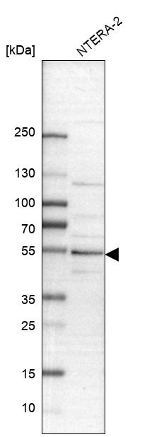 PBX1 Antibody - BSA Free Western Blot: PBX1 Antibody - BSA Free [NBP1-86151]