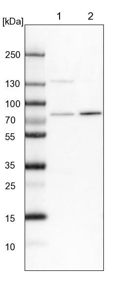 POMT2 Antibody - BSA Free Western Blot: POMT2 Antibody - BSA Free [NBP1-86152]