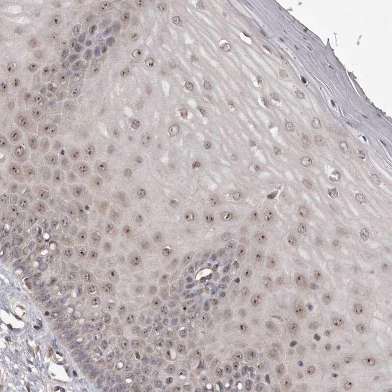NOL12 Antibody - BSA Free Immunohistochemistry-Paraffin: NOL12 Antibody [NBP1-86155]