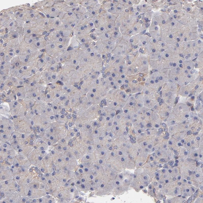 ASB7 Antibody - BSA Free Immunohistochemistry-Paraffin: ASB7 Antibody - BSA Free [NBP1-86157]