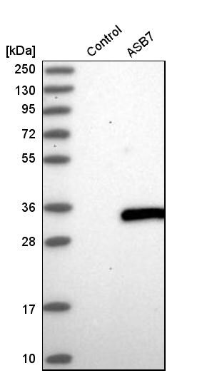 ASB7 Antibody - BSA Free Western Blot: ASB7 Antibody - BSA Free [NBP1-86157]