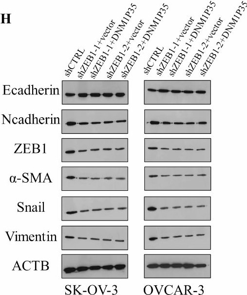 Vimentin Antibody