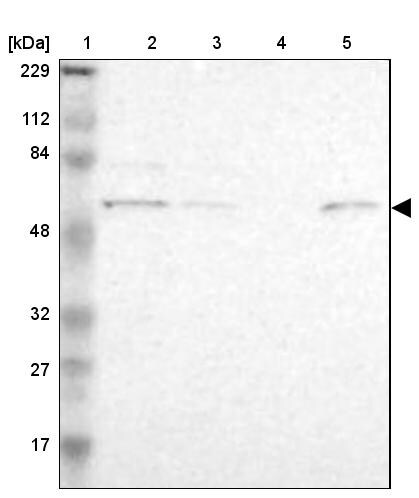 ZNF550 Antibody - BSA Free Western Blot: ZNF550 Antibody - BSA Free [NBP1-86158]