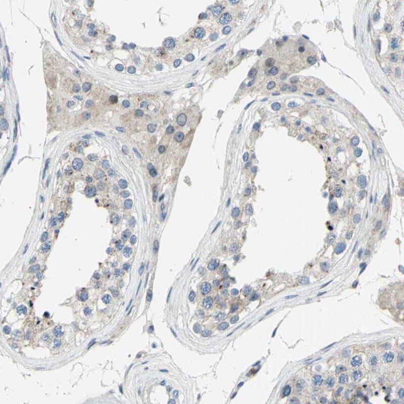 ZNF184 Antibody - BSA Free Immunohistochemistry-Paraffin: ZNF184 Antibody - BSA Free [NBP1-86159]