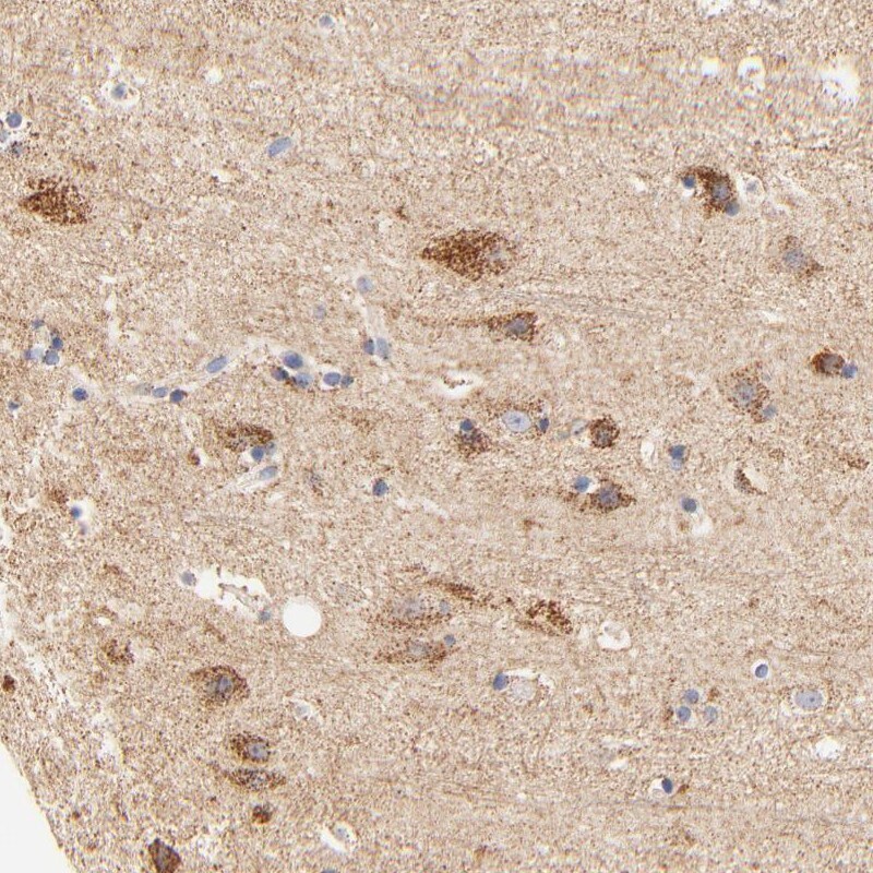 ATP5D Antibody - BSA Free Immunohistochemistry-Paraffin: ATP5D Antibody [NBP1-86162]