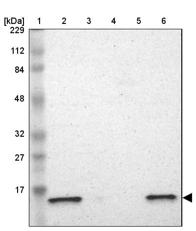ATP5D Antibody - BSA Free Western Blot: ATP5D Antibody - BSA Free [NBP1-86162]