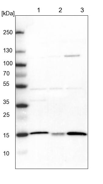ATP5D Antibody - BSA Free Western Blot: ATP5D Antibody - BSA Free [NBP1-86162]