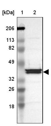 Apolipoprotein A-IV/ApoA4 Antibody - BSA Free Western Blot: Apolipoprotein A-IV/ApoA4 Antibody - BSA Free [NBP1-86164]