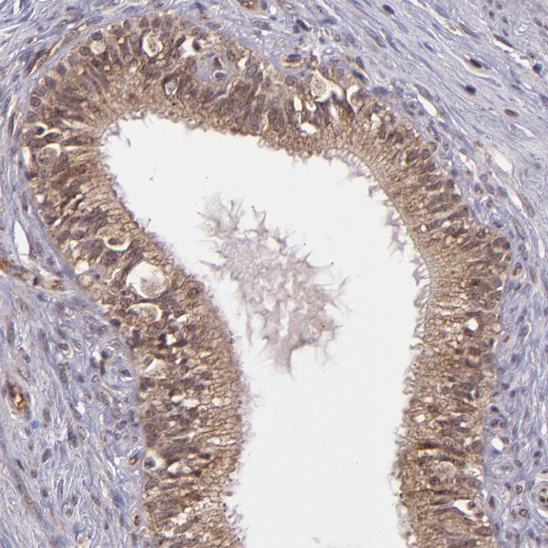 USP51 Antibody - BSA Free Immunohistochemistry-Paraffin: USP51 Antibody - BSA Free [NBP1-86167]