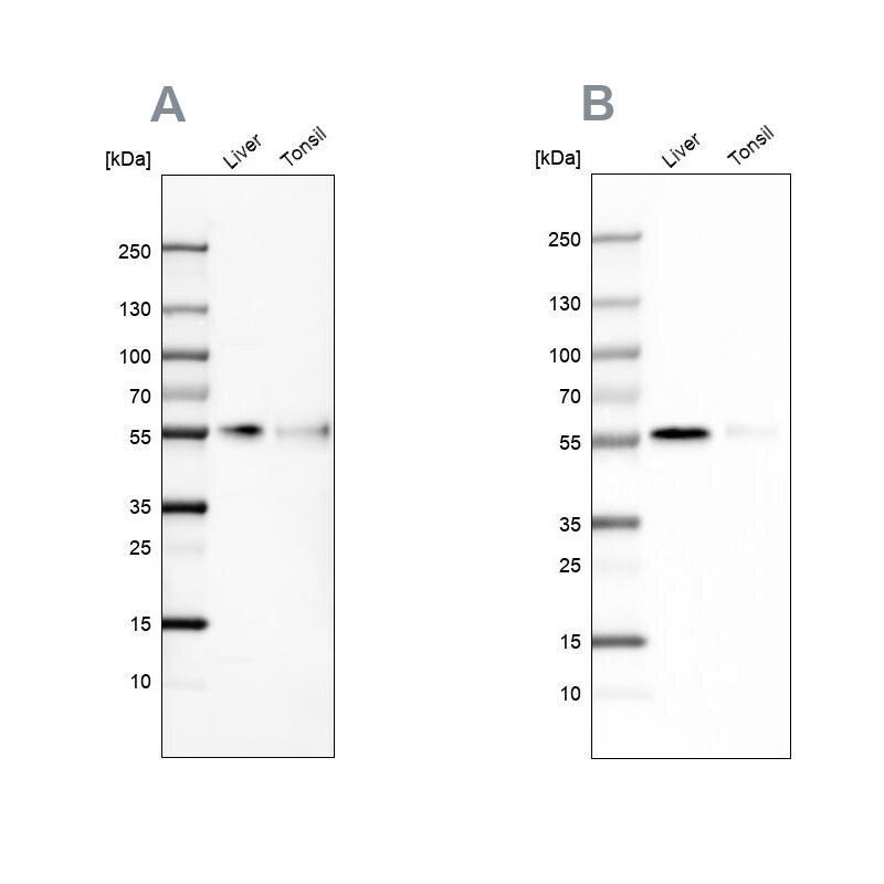 CD14 Antibody - BSA Free Western Blot: CD14 Antibody - BSA Free [NBP1-86168]