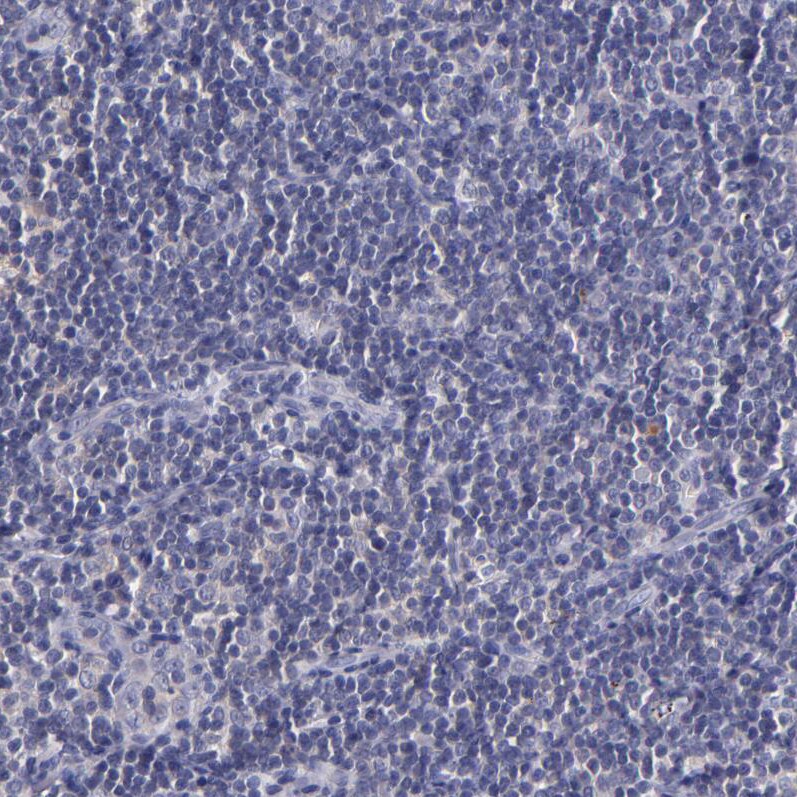RBP4/Retinol-Binding Protein 4 Antibody - BSA Free Immunohistochemistry-Paraffin: RBP4/Retinol-Binding Protein 4 Antibody - BSA Free [NBP1-86173]