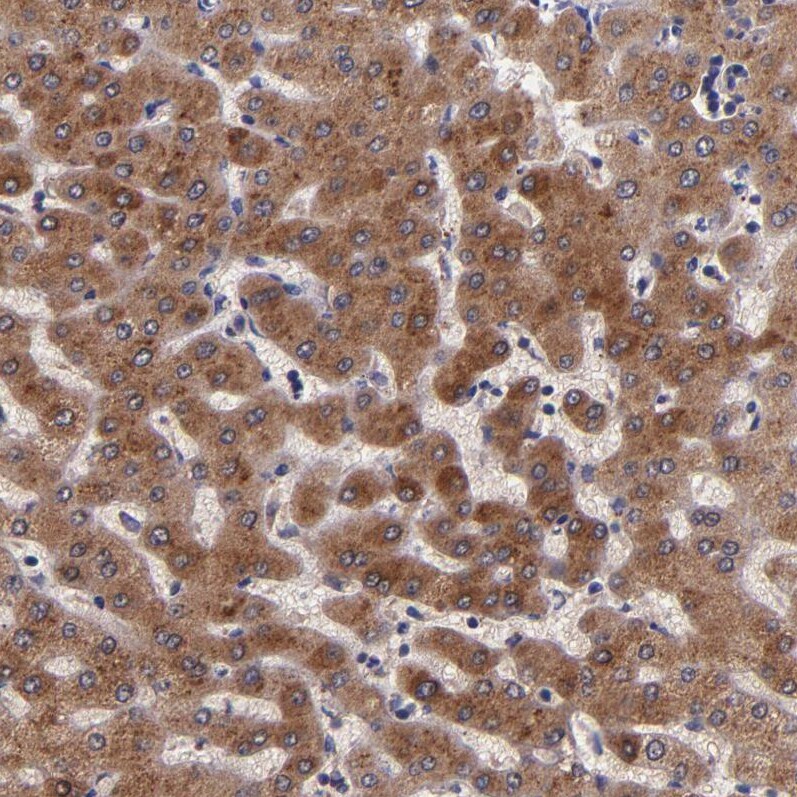 RBP4/Retinol-Binding Protein 4 Antibody - BSA Free Immunohistochemistry-Paraffin: RBP4/Retinol-Binding Protein 4 Antibody - BSA Free [NBP1-86173]