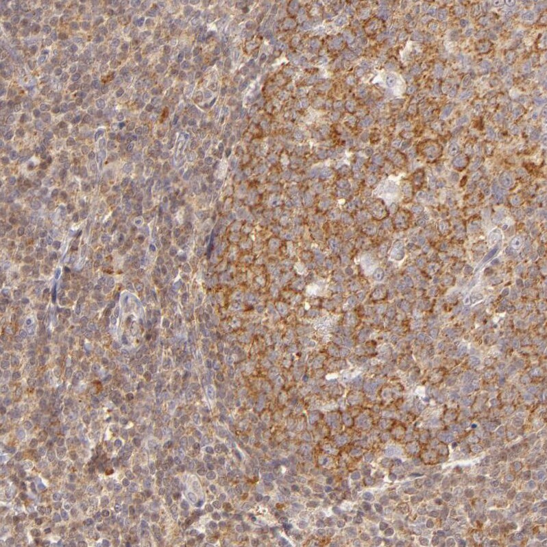 IMP Dehydrogenase 2/IMPDH2 Antibody - BSA Free Immunohistochemistry-Paraffin: IMP Dehydrogenase 2/IMPDH2 Antibody - BSA Free [NBP1-86177]