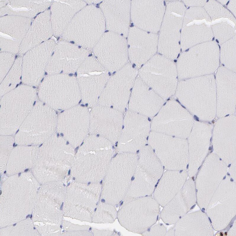 SYK Antibody - BSA Free Immunohistochemistry-Paraffin: SYK Antibody - BSA Free [NBP1-86178]