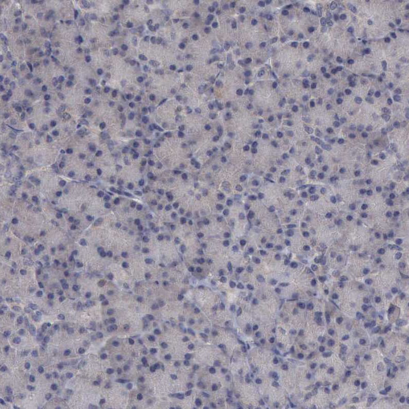 CrkL Antibody - BSA Free Immunohistochemistry-Paraffin: CrkL Antibody - BSA Free [NBP1-86181]
