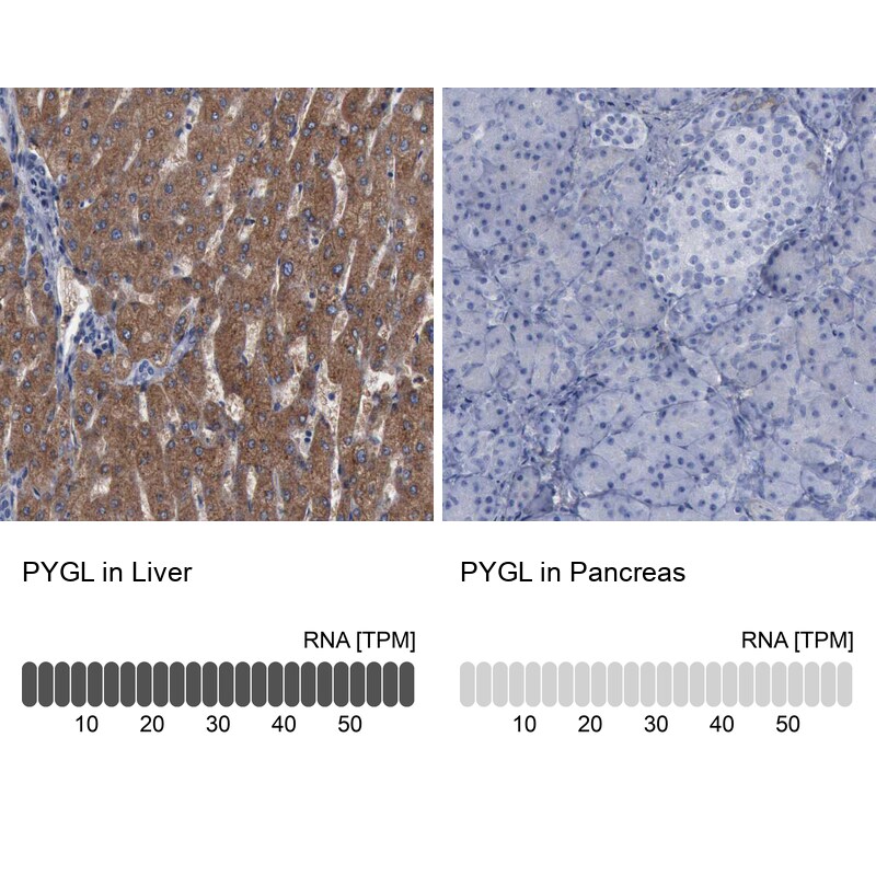 PYGL Antibody - BSA Free Immunohistochemistry-Paraffin: PYGL Antibody [NBP1-86182]