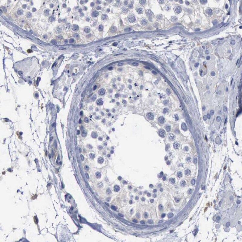 PYGL Antibody - BSA Free Immunohistochemistry-Paraffin: PYGL Antibody [NBP1-86182]