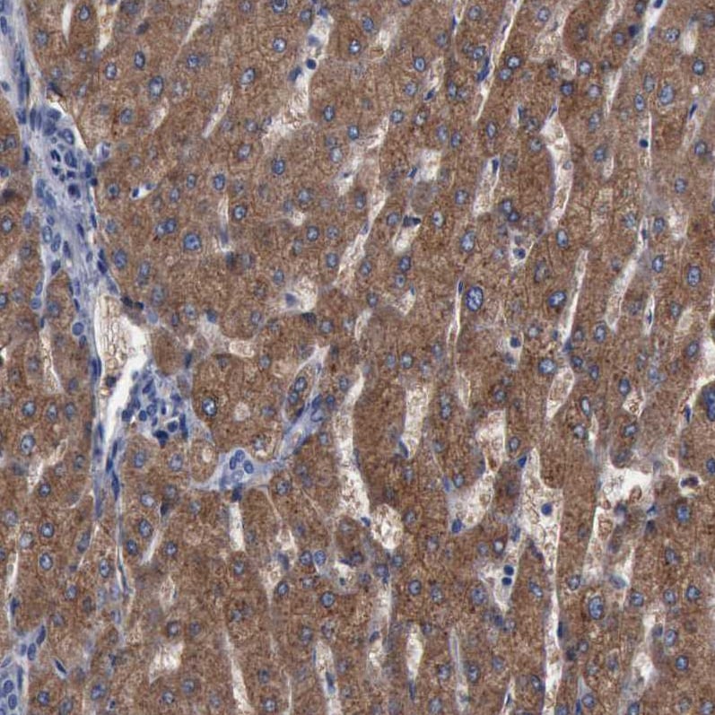 PYGL Antibody - BSA Free Immunohistochemistry-Paraffin: PYGL Antibody [NBP1-86182]