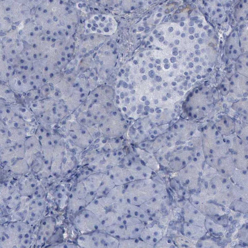 PYGL Antibody - BSA Free Immunohistochemistry-Paraffin: PYGL Antibody [NBP1-86182]