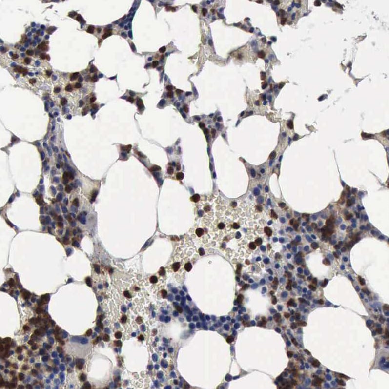 PYGL Antibody - BSA Free Immunohistochemistry-Paraffin: PYGL Antibody [NBP1-86182]