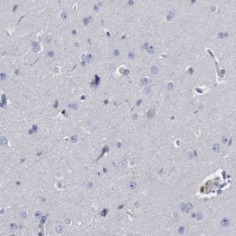 PYGL Antibody - BSA Free Immunohistochemistry-Paraffin: PYGL Antibody [NBP1-86182]
