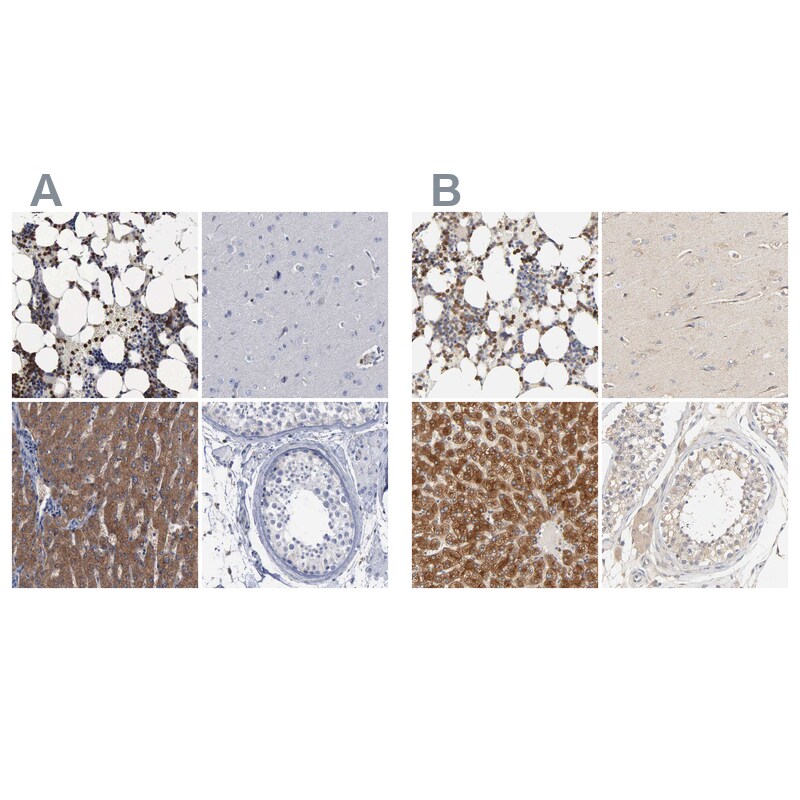PYGL Antibody - BSA Free Immunohistochemistry-Paraffin: PYGL Antibody [NBP1-86182]