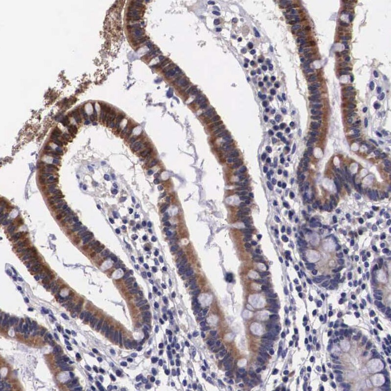 ARG2 Antibody - BSA Free Immunohistochemistry-Paraffin: ARG2 Antibody - BSA Free [NBP1-86189]