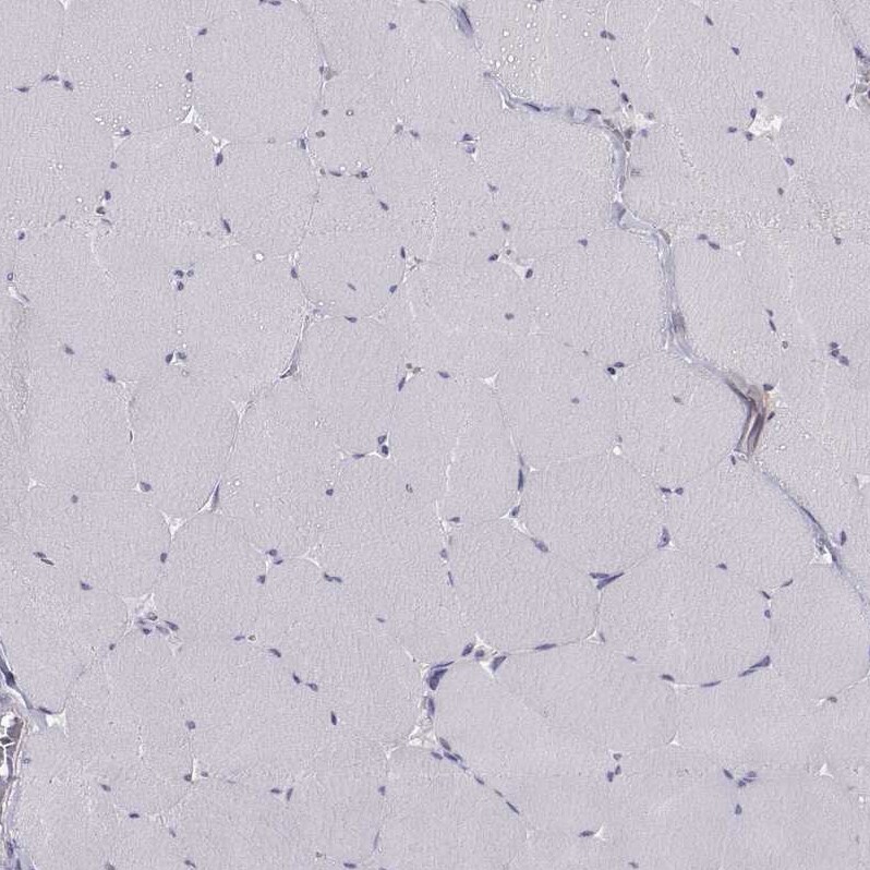 ZNF185 Antibody - BSA Free Immunohistochemistry-Paraffin: ZNF185 Antibody - BSA Free [NBP1-86192]