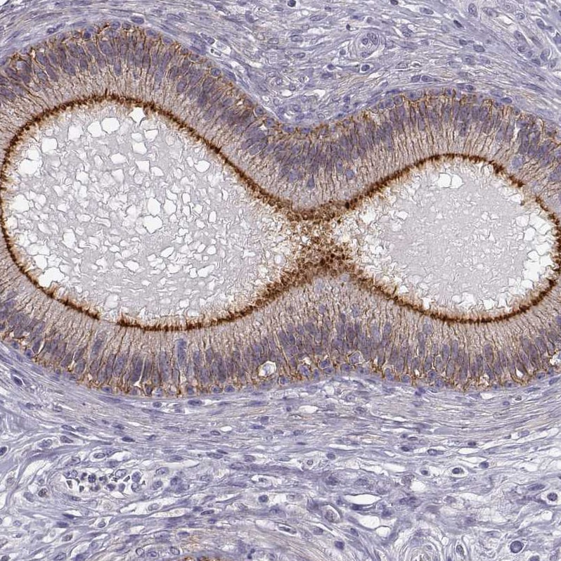 ZNF185 Antibody - BSA Free Immunohistochemistry-Paraffin: ZNF185 Antibody - BSA Free [NBP1-86192]