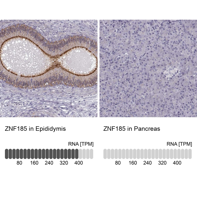 ZNF185 Antibody - BSA Free Immunohistochemistry-Paraffin: ZNF185 Antibody - BSA Free [NBP1-86192]