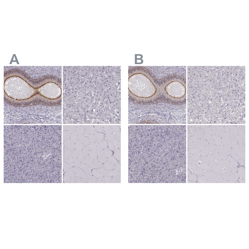 ZNF185 Antibody - BSA Free Immunohistochemistry-Paraffin: ZNF185 Antibody - BSA Free [NBP1-86192]