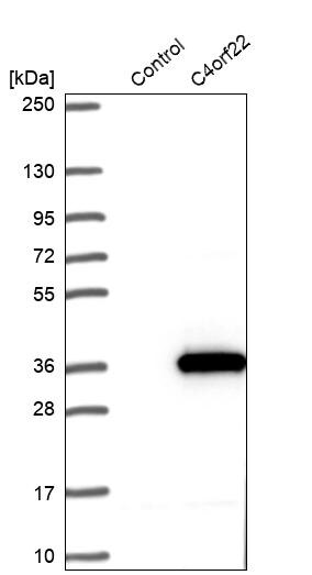CFAP299 Antibody - BSA Free Western Blot: CFAP299 Antibody - BSA Free [NBP1-86203]