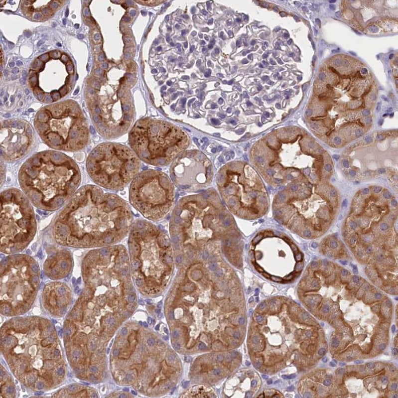 COL19A1 Antibody - BSA Free Immunohistochemistry-Paraffin: COL19A1 Antibody - BSA Free [NBP1-86215]
