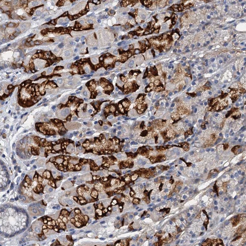 THAP10 Antibody - BSA Free Immunohistochemistry-Paraffin: THAP10 Antibody [NBP1-86226]