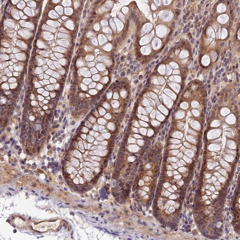 IMPACT Antibody - BSA Free Immunohistochemistry-Paraffin: IMPACT Antibody [NBP1-86234]