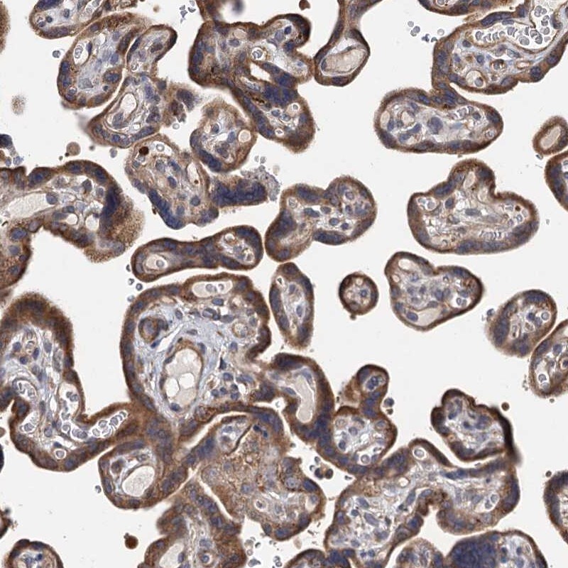 TLDC1 Antibody - BSA Free Immunohistochemistry-Paraffin: TLDC1 Antibody [NBP1-86235]